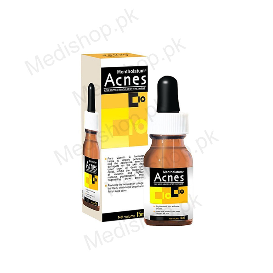 Vitamin c store serum acne